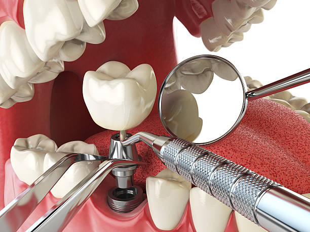 Best Emergency Care for Gum Disease in Double Springs, AL